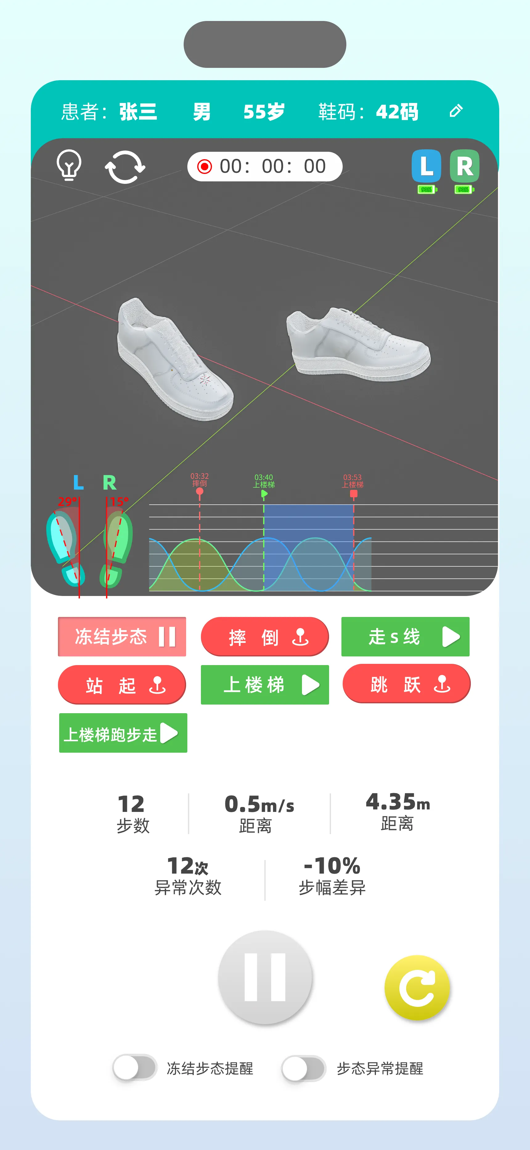 智能步态检测和干预系统 3
